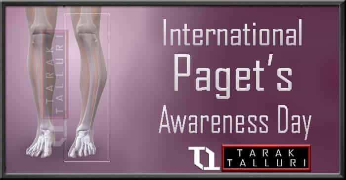 International Paget’s Awareness Day